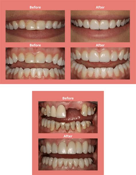 Cosmetic dentistry melbourne fl